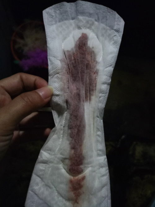 Kehamilan 7Minggu 4hari pendarahan