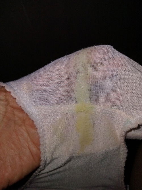 Keputihan diusia 28w