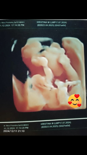 Apa iya jenis kelamin bisa berubah² ?