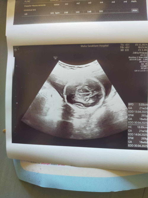 ภาพแรกๆในวงกลมอันนี้คือส่วนไหนคะแม่ๆใช่ศีรษะน้องไหมคะ🙏