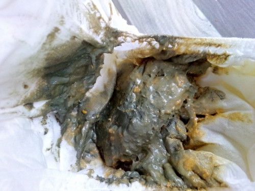 ฮึลูกผิดปกติไหมค่ะ