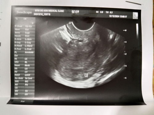 Anong pong ibig Sabihin?