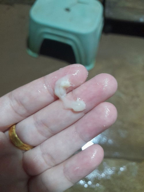 มูกใสใกล้คลอดหรือตกขาว