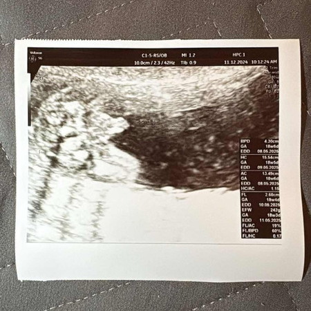 อยากลุ้นเพศลูก แต่...