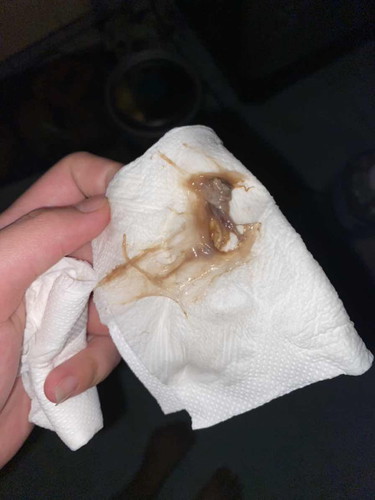 ท้องแรก 39w2d