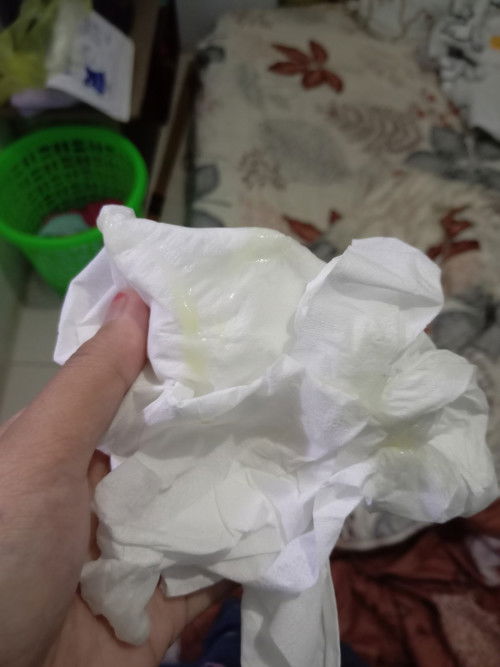 Cairan mucus plug atau bukan