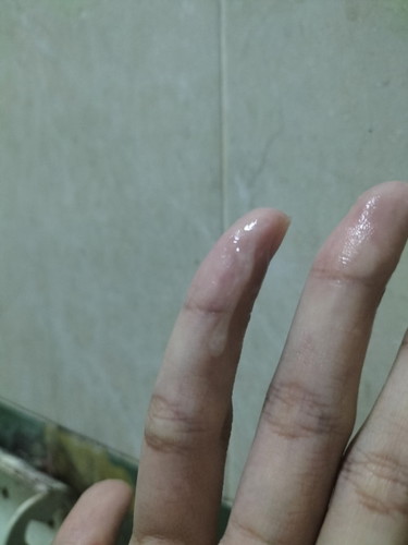 สอบถามแม่ๆ แบบนี้มูกใสหรือเปล่าคะ พอดีท้องแรกค่ะ
