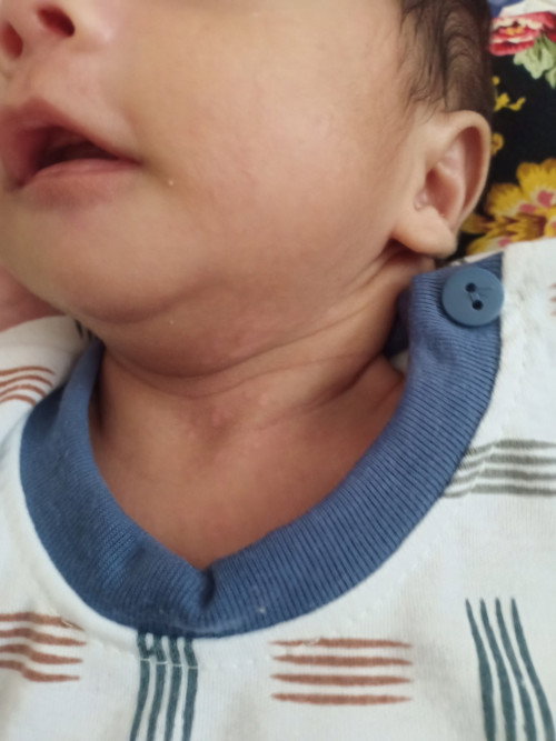 Kulit Newborn