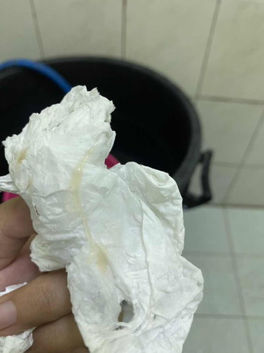 36+2 มีมูกออก