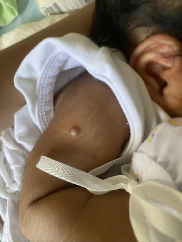 Ano po kaya tong tumubo sa braso ng baby ko