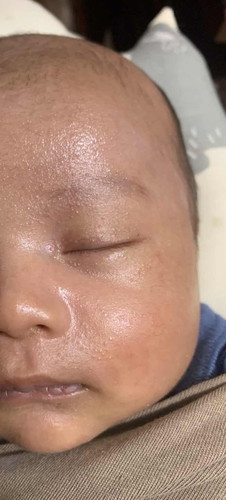 Face cream baby
