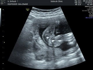 เเบบนี้หญิงหรือชายค่ะ