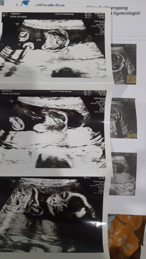 รบกวนสอบถามแม่ๆช่วยดูเพศหน่อยค่ะ