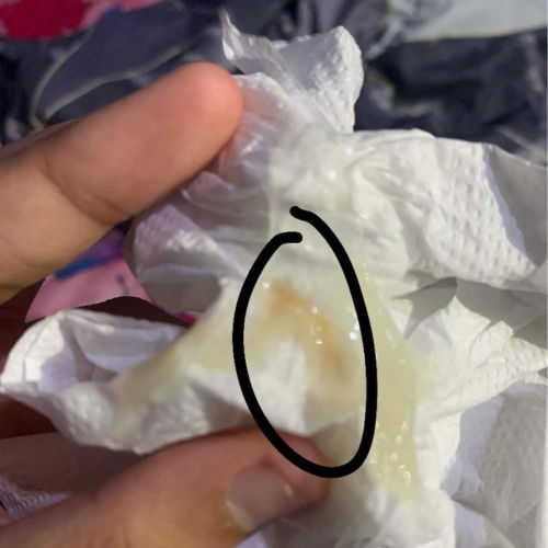 กำลังตั้งครรภ์ใกล้คลอด