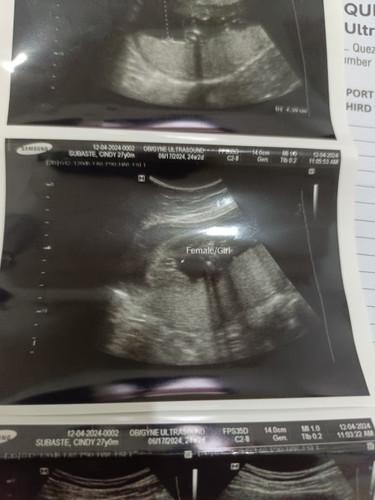 Sure na po kaya na baby girl?