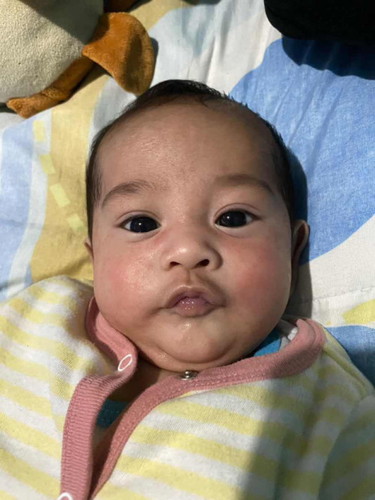 Rashes ng baby mula newborn until now 3 months old