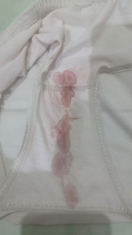 Keluar darah saat hamil 28minggu