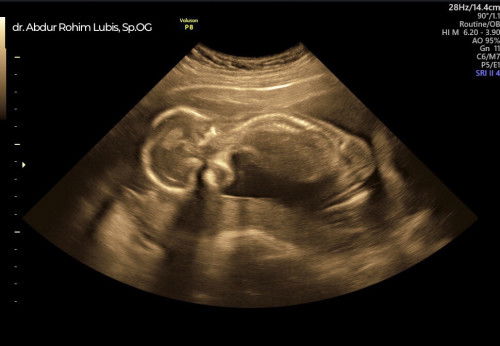 Tips liat jenis kelamin