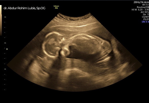 Tips liat jenis kelamin