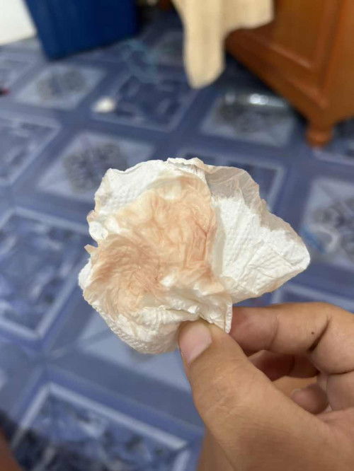 38+2 มีมูกเลือดออก แต่ยังไม่มีอาการเจ็บท้อง น้ำเดิน ต้องไปหาหมอมั้ยค่ะ