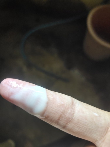 อันนี้คือตกขาวหรือ เมือกค่ะ