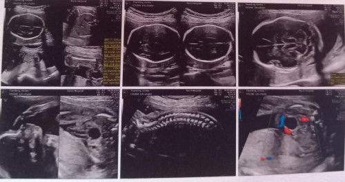 หญิงหรือชายค่ะแม่ๆดูช่วยกันหน่อยย