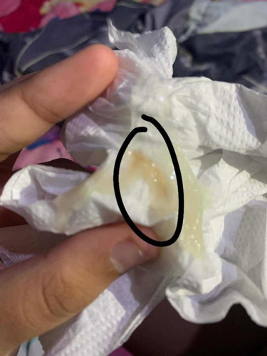 กำลังตั้งครรภ์ 39+2