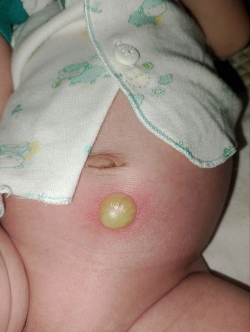 Bun ada yang tau ngak ini namanya apa