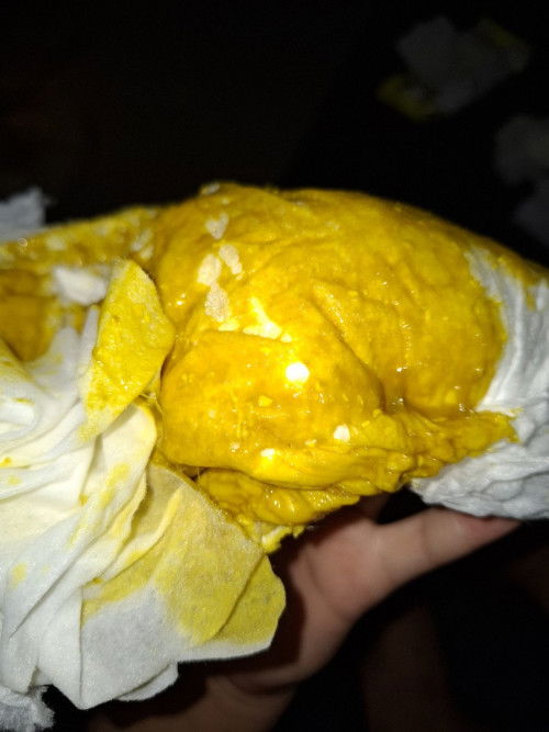 ลูกอึกเป็นมูก