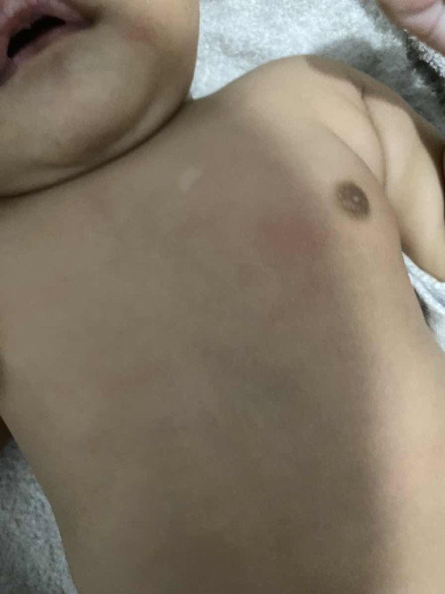 Putih di dada bayi