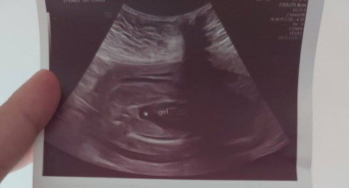 ลูกสาวหรือลูกชายคะ