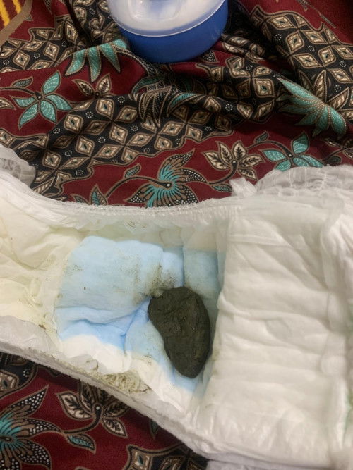 Normal ke ank berak bgni atau sembelit?