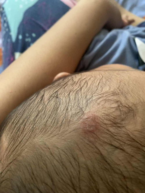 dikasih obat apa ya bunda