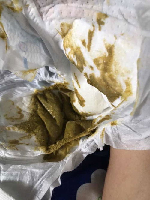 น้องอึกแบบนี้คือเป็นอะไรมั้ยคะหรือว่าปกติ
น้องทานนมผงล้วนค่ะ
ขอโทษคนที่กำลังกินข้าวแล้วมาเห็นรูปด้วยนะคะ