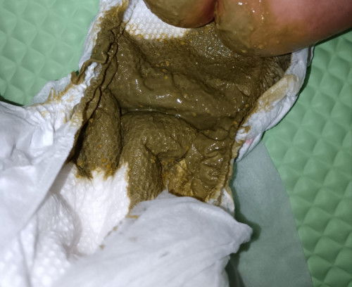 Najis baby 1bulan 23hari first time berubah kaler hijau #susuformulalactogen1