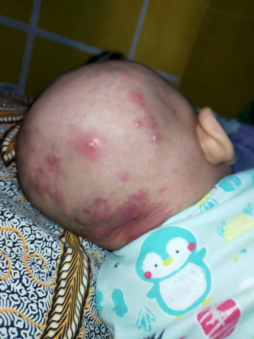 Bayi 2 bulan 22 hari