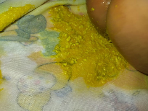 ขอสอบถามหน่อยคะ อึแบบนี้ปกติไหมคะ