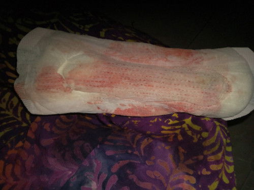 Trismstr 1 . Usia 5weeks