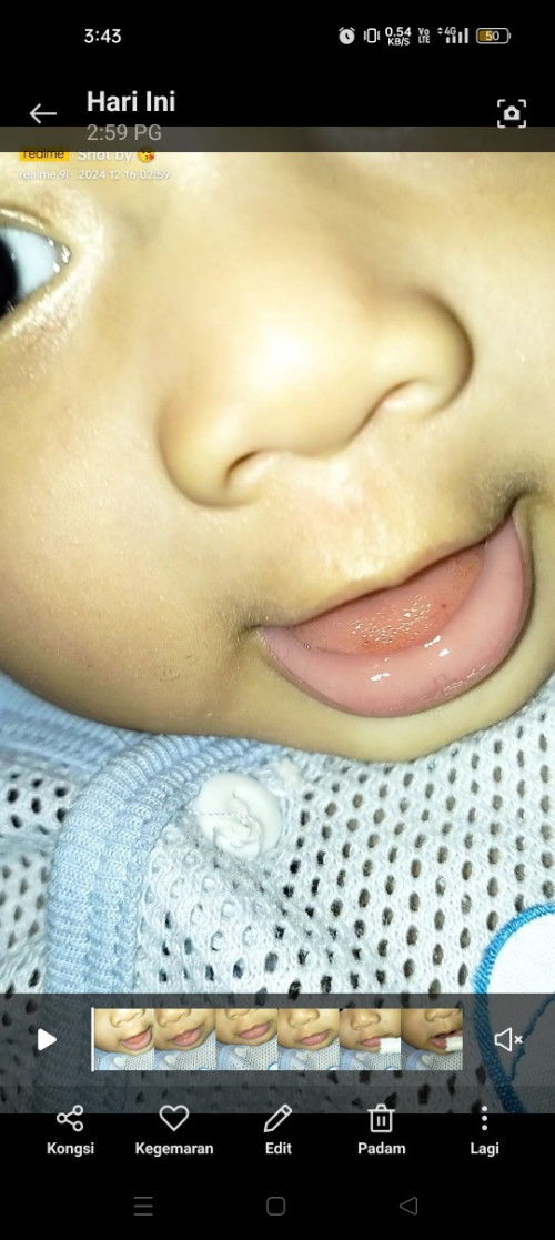 Bintik merah di lidah