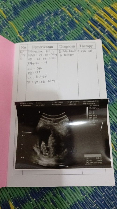 hamil usia 11minggu 6 hari