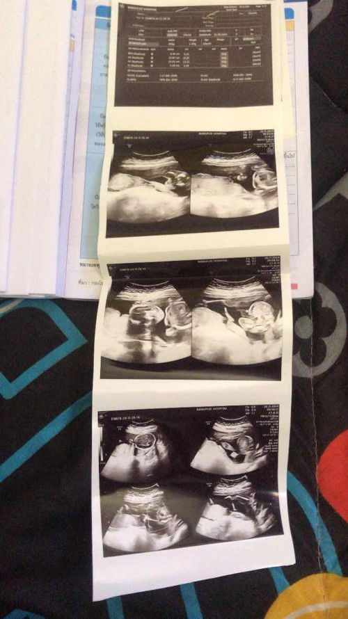 แบบนี้หญิงไหมค่ะ