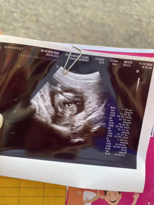 ซาวด์เพศตอน16วีค