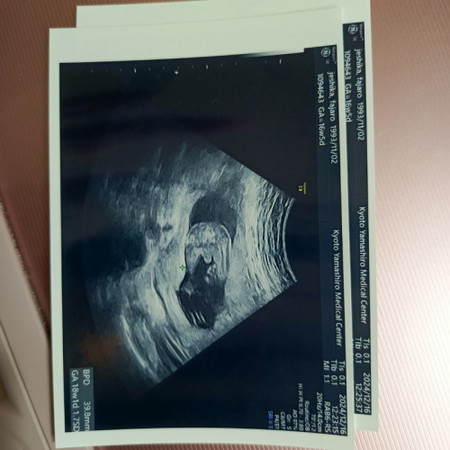 Nakita na po ang gender.. BABY BOY 🍼🍼🍼 TEAM MAY