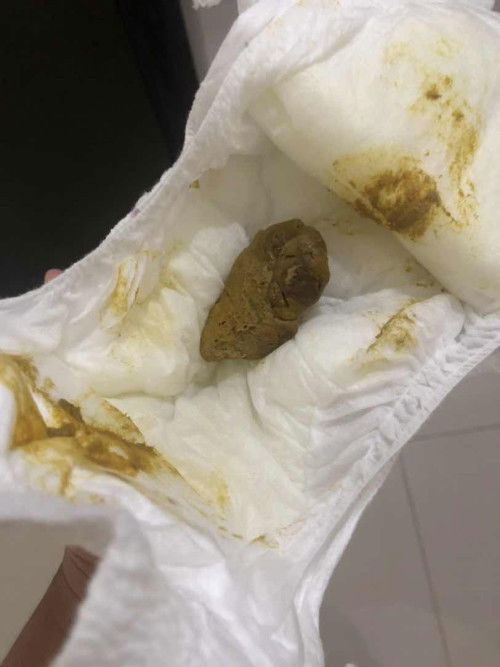 Bab padat dan tidak bertekstur