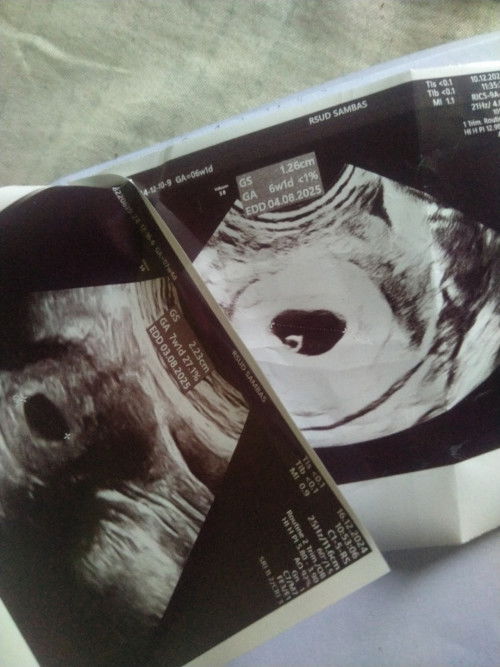 Bakal Janin Tidak Terlihat