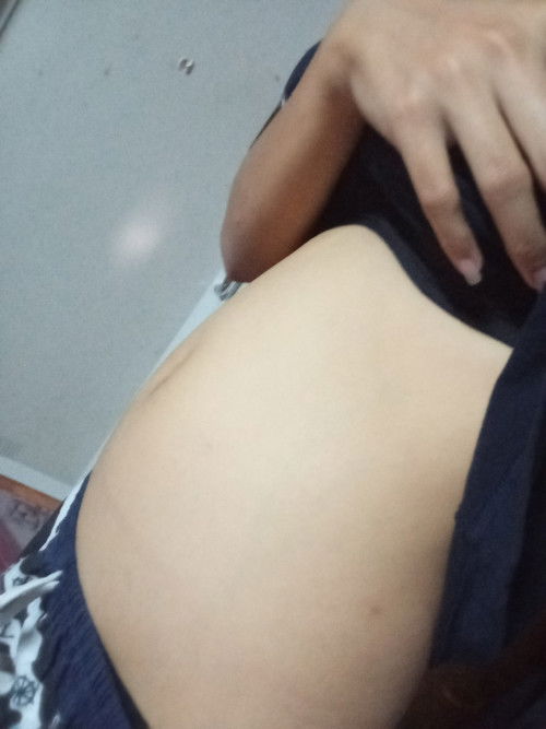 ท้องเล็ก(ท้องแรก)