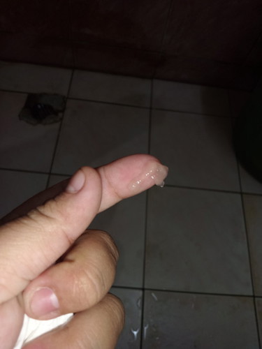 32+5 มีมูกใสออกมา ปกติไหมค่ะ