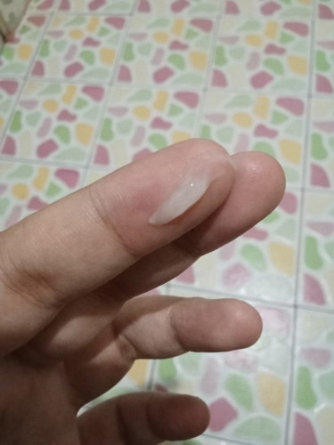 สอบถามคะแม่ๆ อันนี้เรียก มูกหรือตกขาวคะ ท้องแรกด้วย