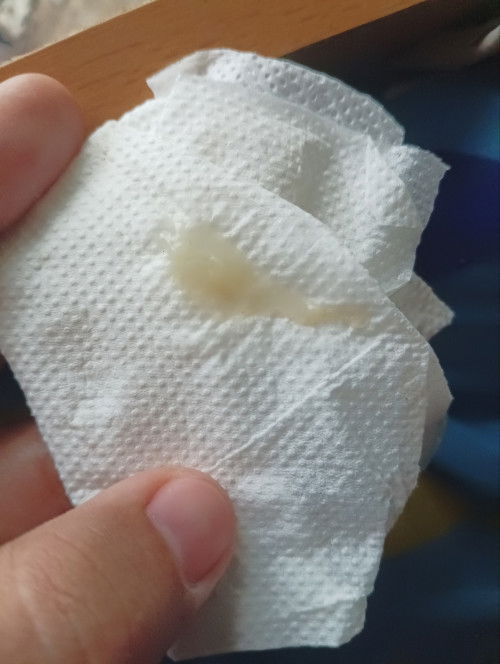 ขอสอบถามแม่ๆหน่อยนะคะ  (38วีค1วัน) ท้องแรก