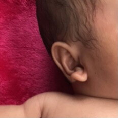 Bentuk Kuping Bayi